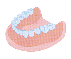 総入れ歯の問題点